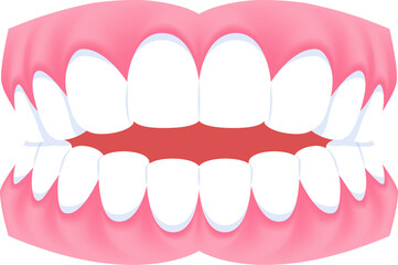Full mouth teeth - Openbite illustration transparent design. Dental care concept.