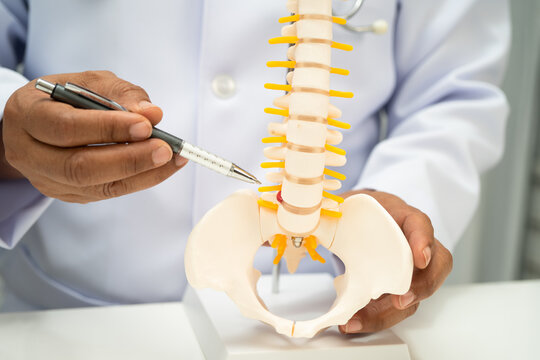 Asian doctor holding spinal nerve and bone model, Lumbar spine displaced herniated disc fragment for treatment medical in the orthopedic department.