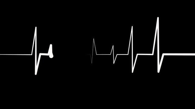 Heartbeat Line Wave Signal Animation with Continuous Pulse and Medical Monitoring
