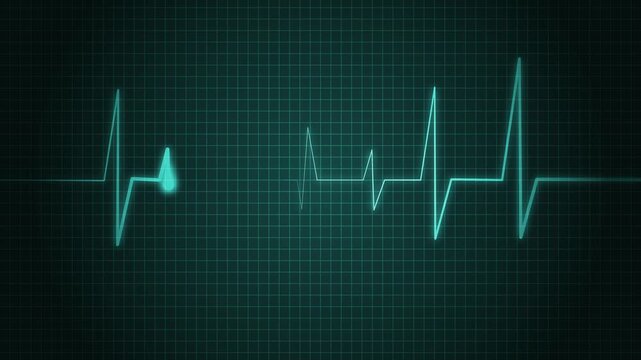 Heartbeat Line Wave Signal Animation with Continuous Pulse and Medical Monitoring