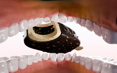 Conceptual Image of Tooth Decay from Eating Ice Cream