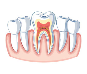 Anatomy of a tooth with gum recession, exposing the root and illustrating potential dental issues and sensitivity	