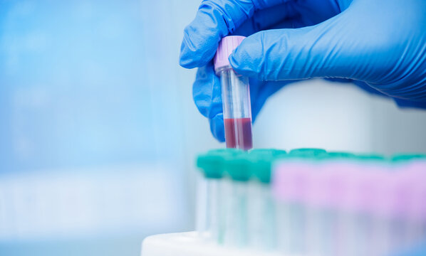 Veterinary clinic blood test: lab work with gloved hand holding sample tube