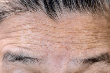 Wrinkles on a man's forehead