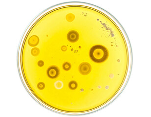 Petri dish with various bacterial colonies growing on a yellow agar