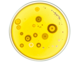 Petri dish with various bacterial colonies growing on a yellow agar