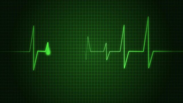 Heartbeat Line Wave Signal Animation with Continuous Pulse and Medical Monitoring
