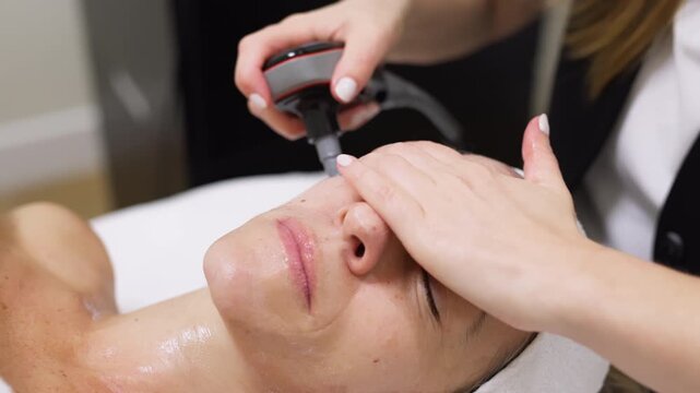 Woman receiving RF lifting treatment for facial rejuvenation in a serene spa environment, showcasing advanced skincare technology and relaxation techniques