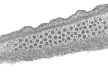 Electron micrograph showing mast cells in the skin, revealing granules filled with histamine and heparin, indicative of immune response and allergic reactions.