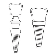 Dental implant, contour. Screw prosthesis, Illustration of dental implantation,orthodontic dental implantation