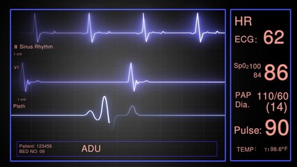 Heart rate monitor in surgery or hospital. Medical vital signs monitor instrument in hospital on anesthesia surgery monitor. ECG. - Powered by Adobe