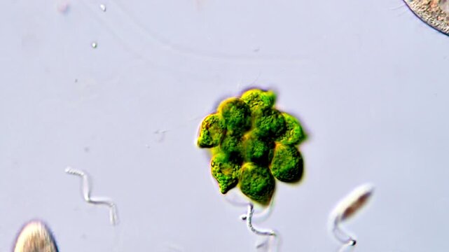 Microalgae under microscope, pond water sample 1000x