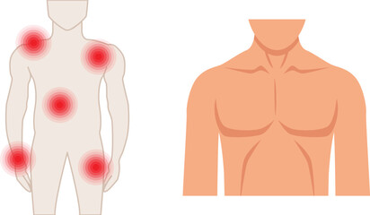 Illustration of a man with pain points in his body, the pain points are marked with red circles on the mans body