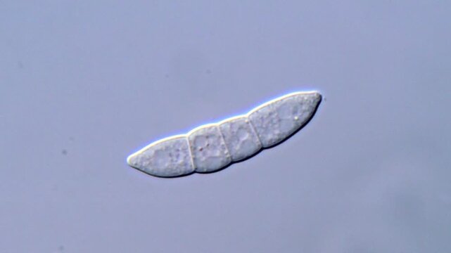 Fusarium Spores Under High Magnification Microscope