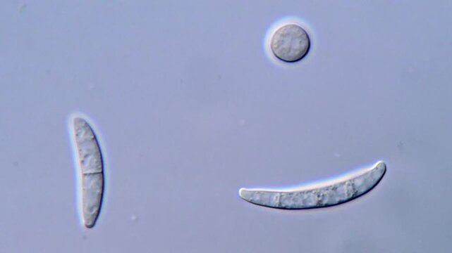 Fusarium Spore Morphology Under High Resolution Microscopy view 