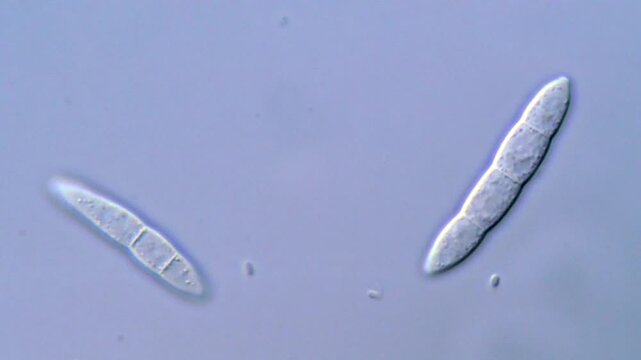 4K Microscopy of Fusarium Fungal spore, 1000x