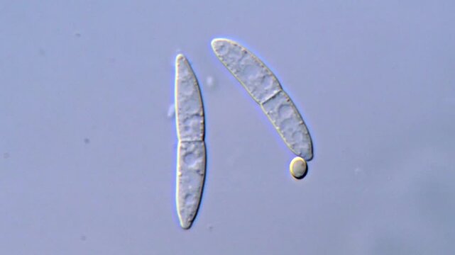 Microscopic Observation of Fusarium Pathogenic Spores, 1000x