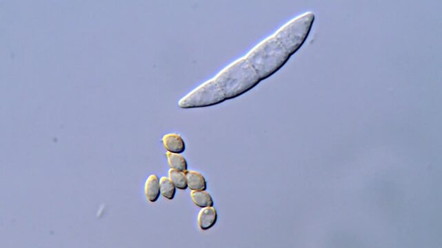 Fungus spore under DIC microscope, Mold fungi 