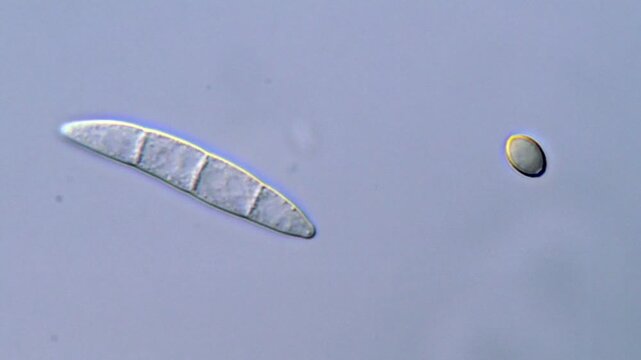 Spore of fungi under microscopy view 