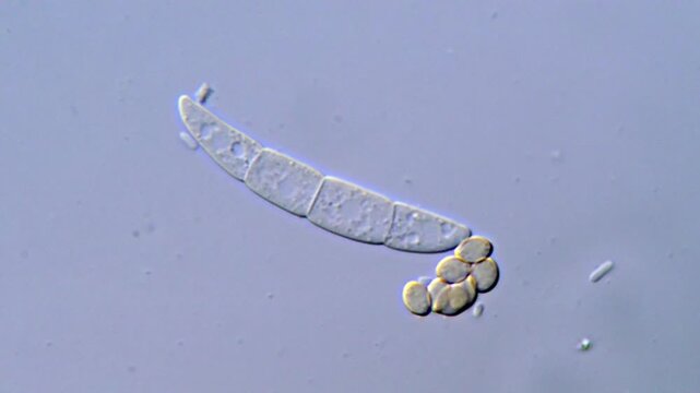 Spore of fungi under microscope 