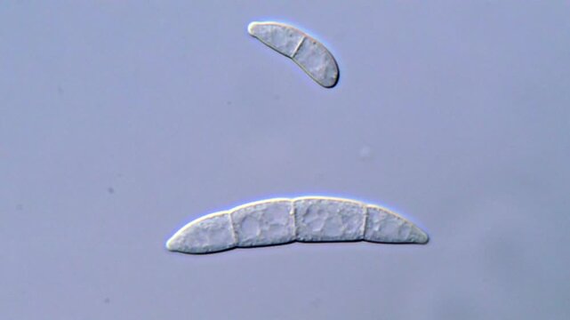 Fungi under microscope 