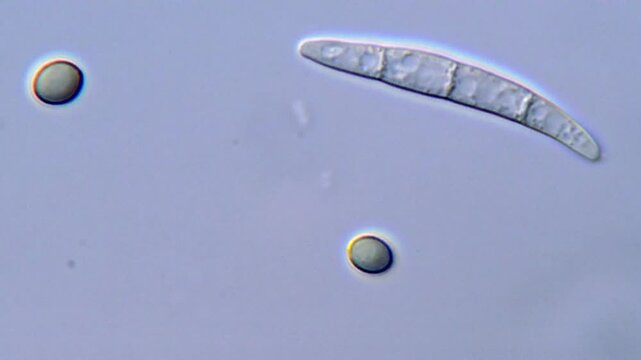 Fungi spore under microscope, High Resolution video 