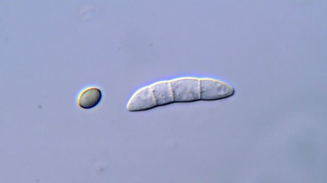 Fungal spore under DIC microscope 