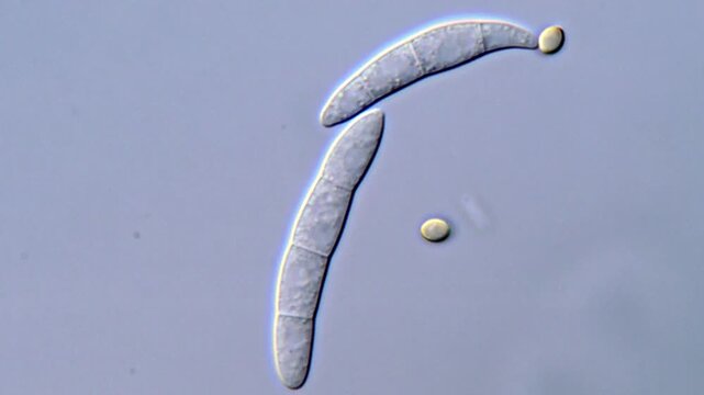 Fungi spore under DIC microscopy view 1000x magnification 