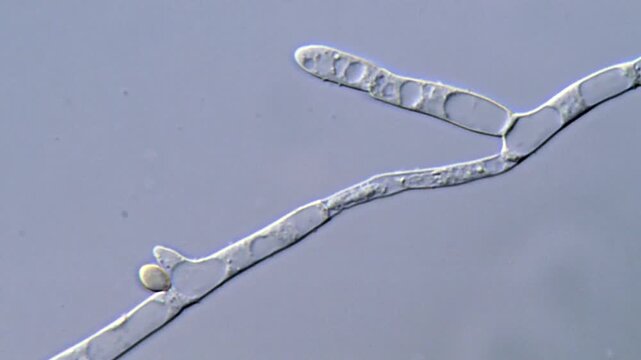 Mold Hyphal Structures and Spores Under Microscope