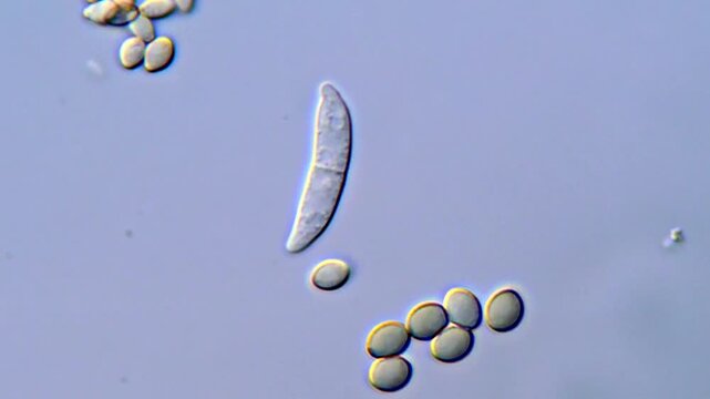 Fungi spores under microscope, microorganism under microscopy 