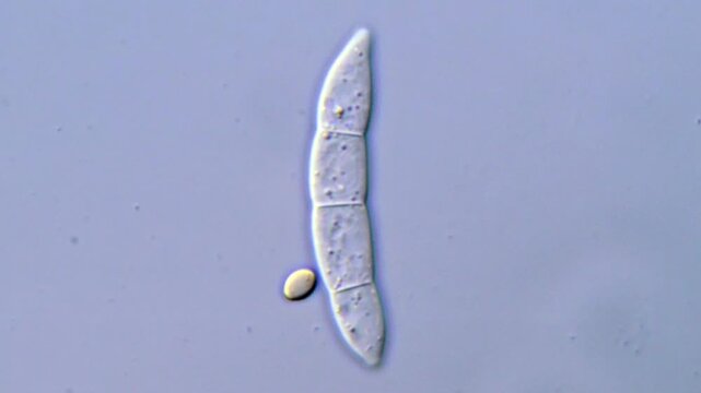 Fungus spore under High Resolution microscope 