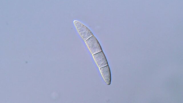  filamentous fungi spore under microscopy view 