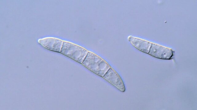 High Definition Microscopic Footage of Fusarium Spores