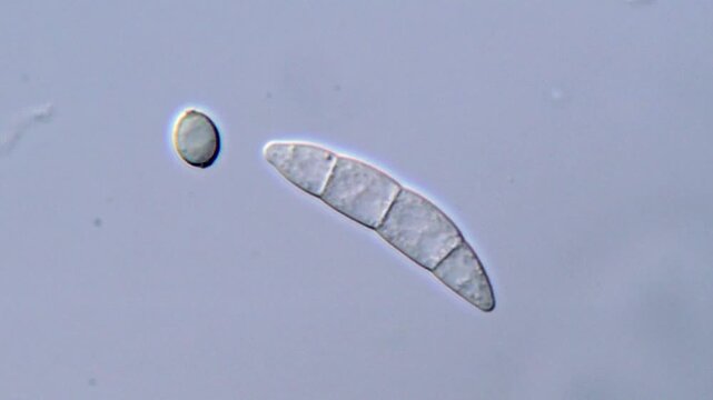 Fungi under DIC microscopy 