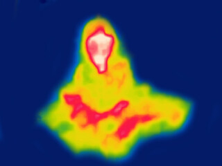 A hooded and uncovered man sitting in the lotus position. Image from thermal imager device.
