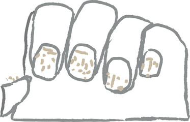 Broken fingernail reveals damaged nail bed and skin infection concern