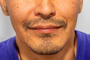 Obraz premium A 47 year old Kazakh man with facial hair and freckles smiles sweetly. Close-up of his mouth. Dentistry.