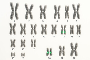 Karyotype showing human chromosomes arranged in homologous pairs and numbered by size from 1 to 22, with sex chromosomes X and Y. Chromosome 12 displays a fluorescent green enhancement.