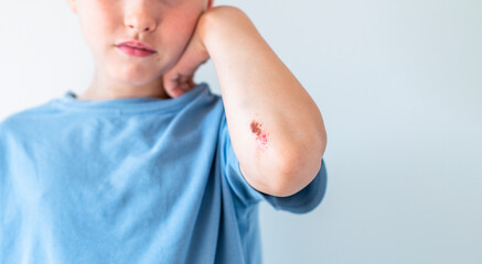 Child showing a painful scraped elbow with an open wound on the skin, a common minor injury from an...