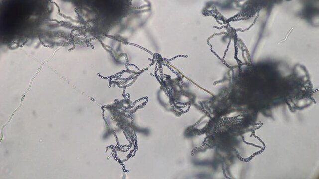 Aerial mycelium and mold spores under a microscope.