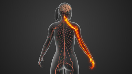 Cervical Nerve Leading to Radiating Neck and Arm Pain