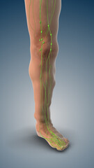 Pitting Edema Due to Fluid Overload