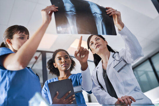 Doctors, xray analysis and results with tablet in clinic for joint dislocation, fracture or surgery planning. Medical team, women and point to knee scan for injury review, osteoporosis and low angle