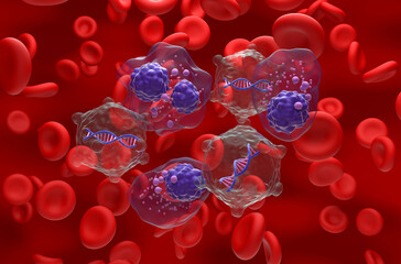 Gene therapy in Multiple myeloma (MM) - isometric view 3d illustration