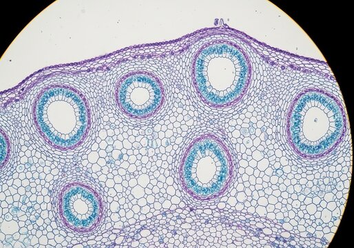 Hyper-detailed microscopic cross-section of monocot stem showing scattered vascular bundles enclosed by sclerenchyma, fragile anatomical clarity preserved in magnified view