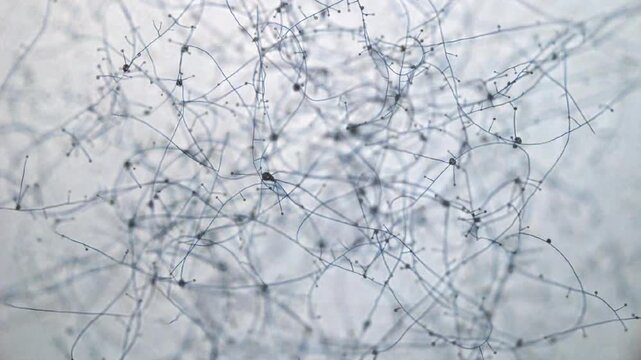 Threads and mycelium with mold spores when magnified under a microscope. Thin threads of mycelium.
