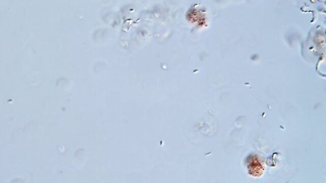Microscopic Life: Aeolosoma Worms Swimming Gracefully,  darkfield microscopy 