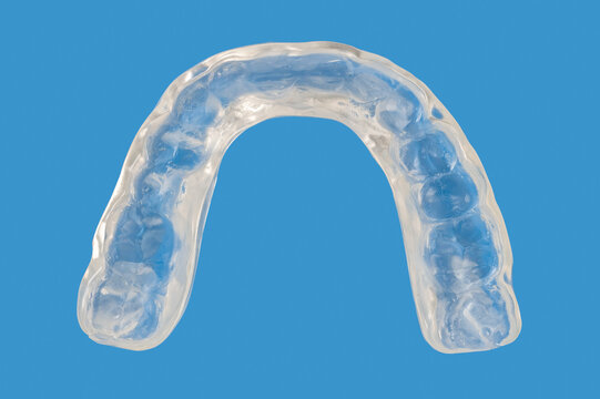 Invisible orthodontics cosmetic brackets on blue background, tooth aligners, plastic braces. Modern teeth retainers created on a 3d printer. A way to have a beautiful smile and white teeth.
