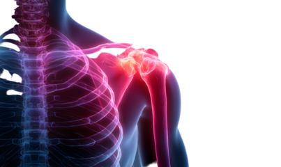 Shoulder muscle pain x-ray concept, medical treatment, rehabilitation and injury concept.