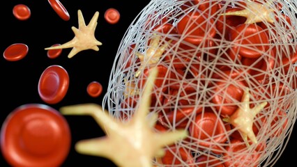 The 3D image of thrombus formation within a blood vessel with activated platelets and fibrin aggregates- the primary cellular and protein components involved in clot development